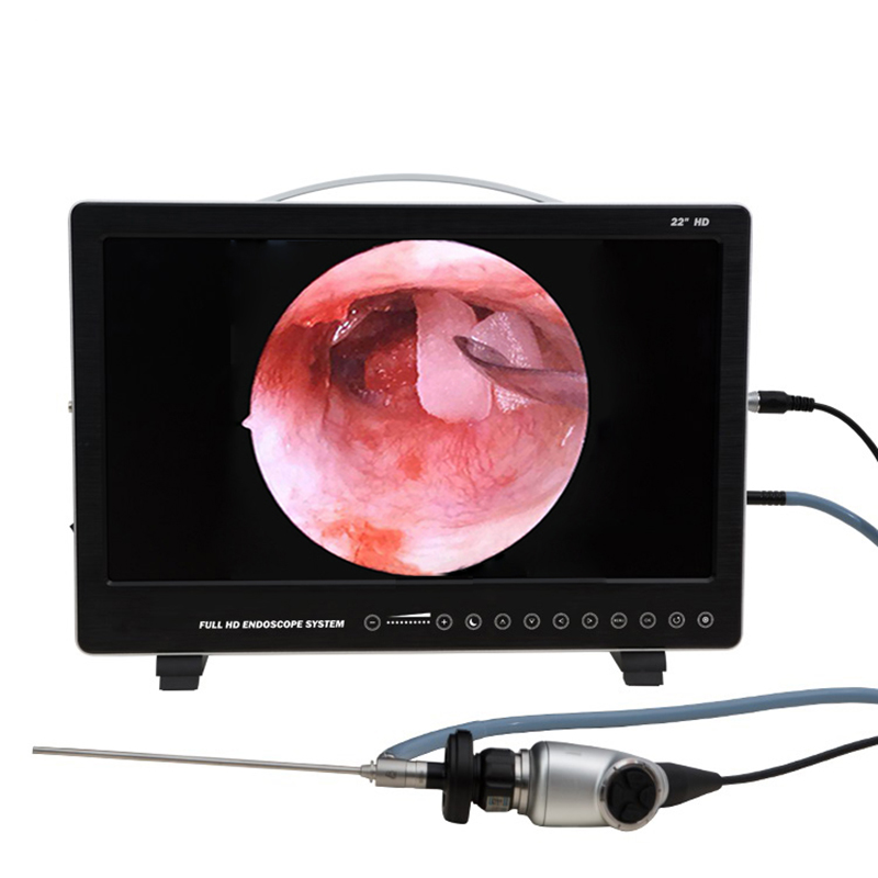 22 Inch Endoscope Camera Syste - огляд і ціна Laptop Accessories All In One
